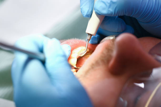Best Mobile Emergency Dentist in Alvarado, TX
