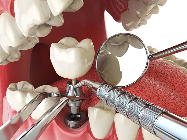 Best Emergency Dental Services for Seniors in Alvarado, TX